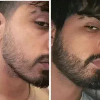 مثل آب خوردن ربشاتو پرپشت کن