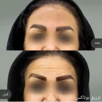 تخفیف ویژه شب یلدا خدمات زیبایی|خدمات آرایشگری و زیبایی|مشهد, کوشش|دیوار