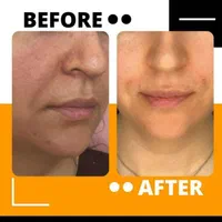 مرکز لیزر و زیبایی دکتر فروغ احمدی پور|خدمات آرایشگری و زیبایی|پردیس, فاز ۴|دیوار