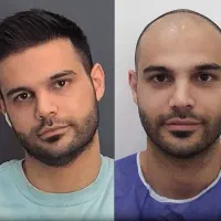 کاشت مو و ابرو با ضمانت/نقد و اقساط/