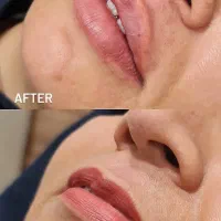 بلک فرایدی زیبایی کلینیک دکتر محمودی