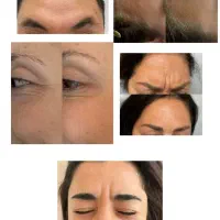 خدمات پوست و مو|خدمات آرایشگری و زیبایی|مراغه, |دیوار