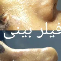 تخفیف ویژه خدمات زیبایی|خدمات آرایشگری و زیبایی|کوهدشت, |دیوار
