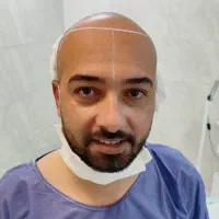 کاشت مو و ابرو در گلپایگان|خدمات آرایشگری و زیبایی|فریدونشهر, |دیوار