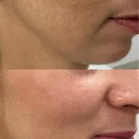 اموزش پاکسازی پوست|خدمات آموزشی|فولادشهر, B4|دیوار