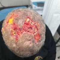 پانسمان هوشمندنانوفیبرتمام گیاهی باسرعت درمان بالا|آرایشی، بهداشتی، درمانی|مشهد, هفت تیر (حافظ)|دیوار