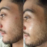 خدمات درمانی پوست