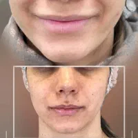 درمان کامل انواع لک پوستی توسط پزشک|خدمات آرایشگری و زیبایی|اصفهان, سعادتآباد|دیوار