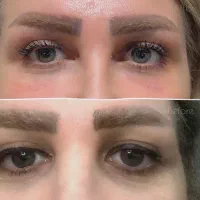 ژل بوتاکس کانتورینگ صورت آنزیم فیلر بینی مزوژل|خدمات آرایشگری و زیبایی|گرمسار, |دیوار