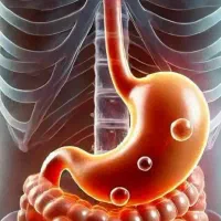 درمان نفخ و ورم معده