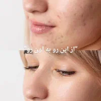 ریتاچ و روتوش و با کیفیت کردن عکس و ادیت ..|خدمات رایانه‌ای و موبایل|سنندج, |دیوار