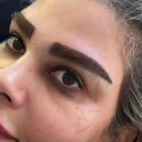 کاشت مو و ابرو|آرایشی، بهداشتی، درمانی|کرج, دانشگاه هنر تهران (پردیس کرج)|دیوار