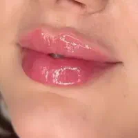 جشنواره پاییزه فیلر و بوتاکس با ۵۰ درصد تخفیف|خدمات آرایشگری و زیبایی|تهران, قیطریه|دیوار