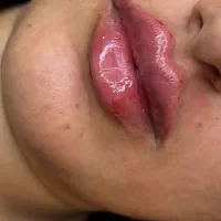 ۲۰ درصد تخفیف خدمات ژل و بوتاکس|خدمات آرایشگری و زیبایی|دوگنبدان, |دیوار