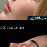 کاشت