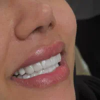 خدمات دندانپزشکی بدون پیش پرداخت