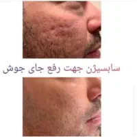 کلاس زیبایی برای همه|خدمات آموزشی|کرمانشاه, |دیوار