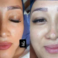 فیشیالی ست مراقبت های پوستی