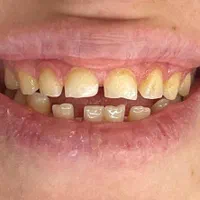 تمامی خدمات دندانپزشکی و کامپوزیت و فیسینگ|خدمات آرایشگری و زیبایی|شیراز, فرهنگ شهر|دیوار