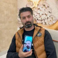 کاشت مو باضمانت شروع از ۷ ملیون