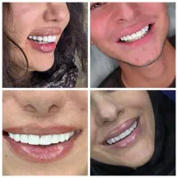 فقط با 10 میلیون کامپوزیت کن / مشاوره رایگان