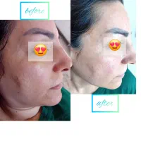 فشیال ، مژه