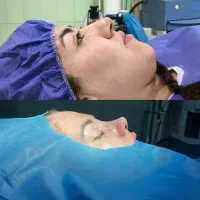 جشنواره عمل بینی با تخفیف آبان به رسم هرساله|خدمات آرایشگری و زیبایی|ساری, |دیوار