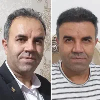 کاشت مو وابرو|خدمات آرایشگری و زیبایی|سقز, |دیوار