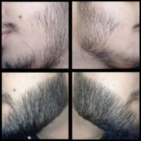 بازگشت اعتماد به نفس تضمینی