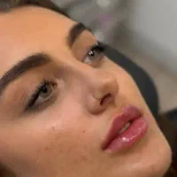 فیلر ژل لب تخصصی بوتاکس پزشک کلینیک زیبایی|خدمات آرایشگری و زیبایی|تهران, تهرانسر مرکزی|دیوار