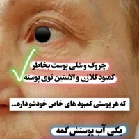 کرم ضدلک قوی لاکچری کوئین|آرایشی، بهداشتی، درمانی|تهران, استخر|دیوار