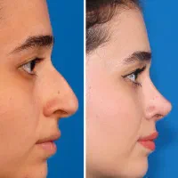 فرصت استثنایی عمل بینی