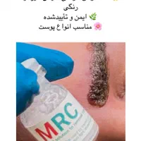 ریموو آرایش دائم با مواد تک جلسه ای MRC|خدمات آرایشگری و زیبایی|مشهد, سجاد شهر|دیوار