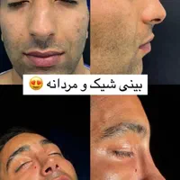 جشنواره جراحی بینی|خدمات آرایشگری و زیبایی|بروجرد, |دیوار