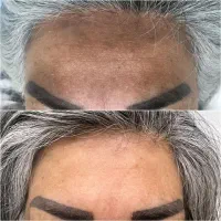 سالن تخصصی پوست ومو توسط منتخب مسابقات پوست کشور|خدمات آرایشگری و زیبایی|ساری, |دیوار