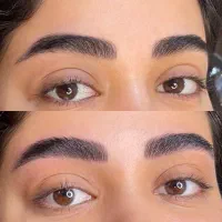 تخفیف میکروبلیدینگ ابرو به روش نانوبروز