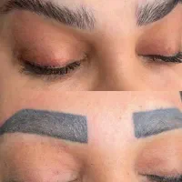 ریموو تتوی قدیمی ابرو