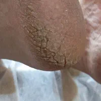 اسپا پدیکوریست