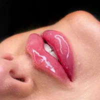 تزریق ۱۰سیسی فول فیس ۳۹۹۰ ژل بوتاکس آنزیم توسطپزشک|خدمات آرایشگری و زیبایی|کرج, گلشهر|دیوار