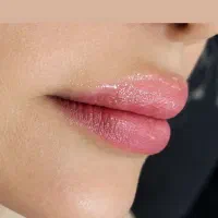 فیلر وبوتاکس