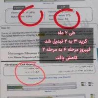 ۴۷٪ مردم بیرجند در خطر کبد چرب|خدمات آرایشگری و زیبایی|بیرجند, |دیوار
