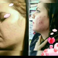 کرم  خلطه عراقی با صابون برنج اصل