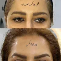 تزریقات ژل و بوتاکس|خدمات آرایشگری و زیبایی|دوگنبدان, |دیوار