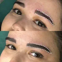 میکروبلیدینگ|خدمات زیبایی و سلامت|رشت, پاستوریزه|دیوار