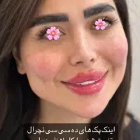 جشنواره ژل و بوتاکس توسط پزشک