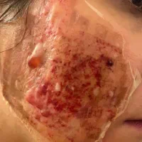 پانسمان هوشمندنانوفیبرتمام گیاهی باسرعت درمان بالا|آرایشی، بهداشتی، درمانی|مشهد, هفت تیر (حافظ)|دیوار