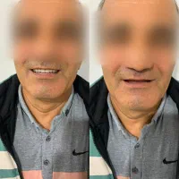 سلامت وزیبایی دندان