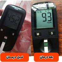 درمان ریشه ای دیابت قطع قرص و انسولین|خدمات آرایشگری و زیبایی|ملایر, |دیوار