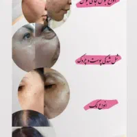 پوست و مو