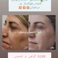 کرم انحصاری درخشان بدون بازگشت|آرایشی، بهداشتی، درمانی|رشت, منظریه|دیوار